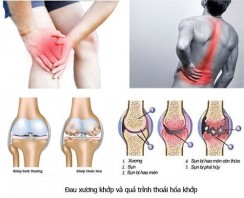 Bệnh lý cơ xương khớp: Bệnh nghề nghiệp phổ biến nhất thế giới